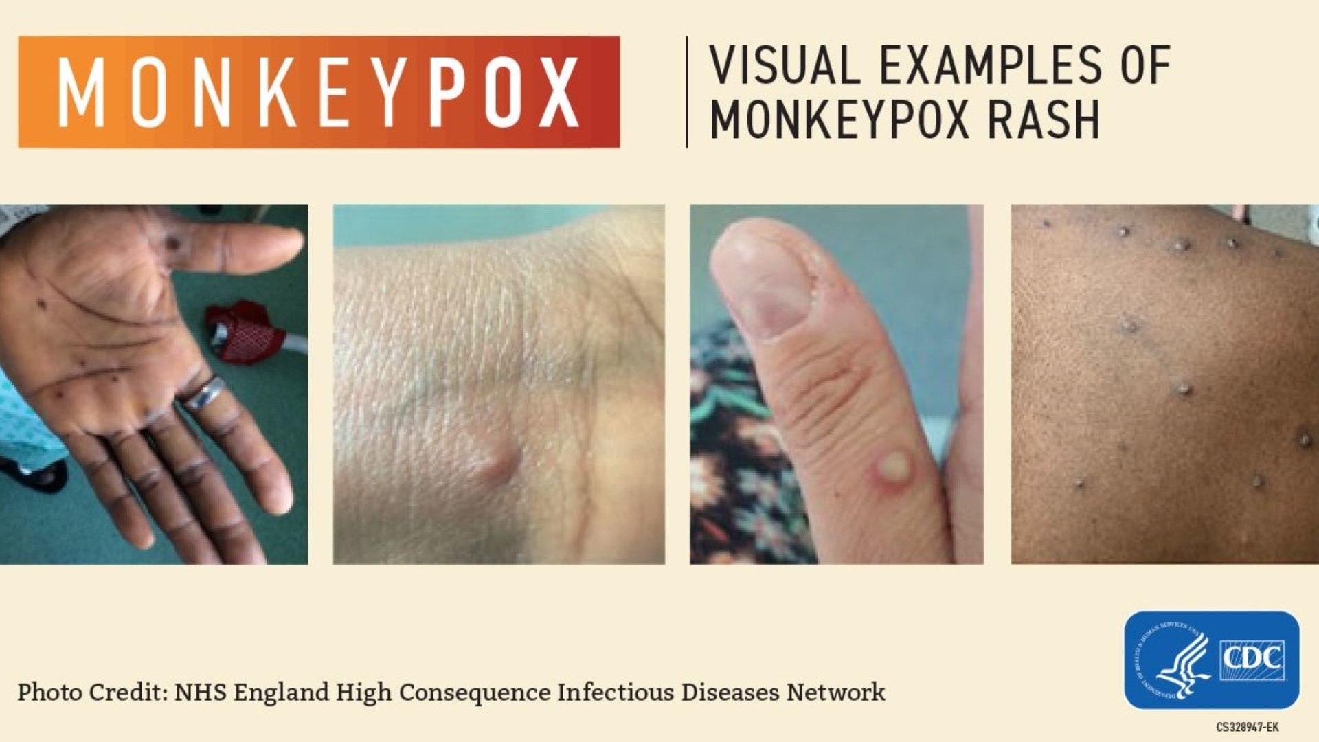 The Brazos County Health District will not be providing monkeypox testing, according to Mary Parrish with the organization