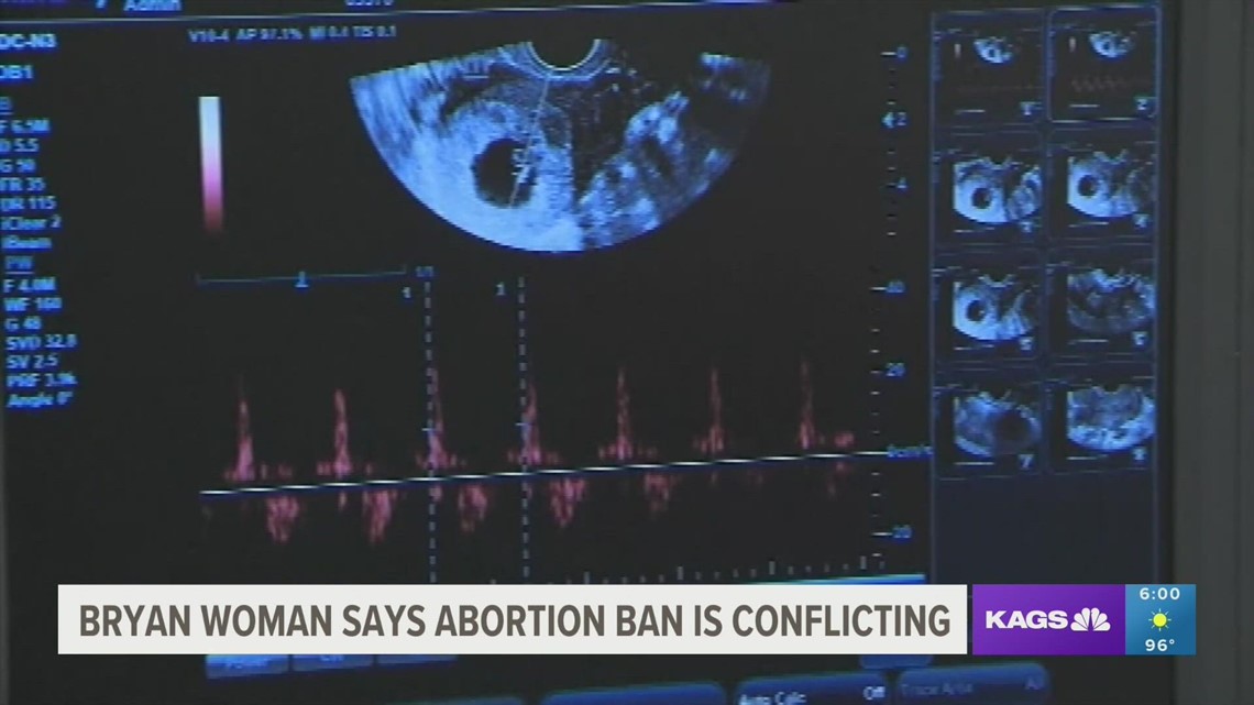 Bryan woman voices concerns over Texas trigger law banning abortions
