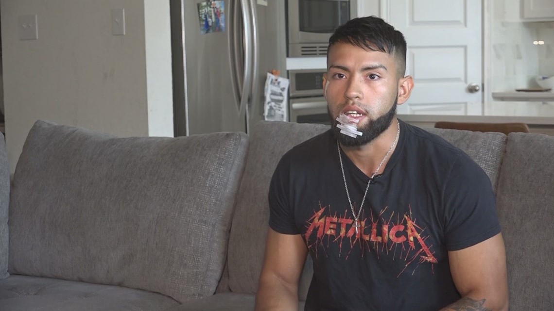 Amazon driver recalls surviving dog attack on south side