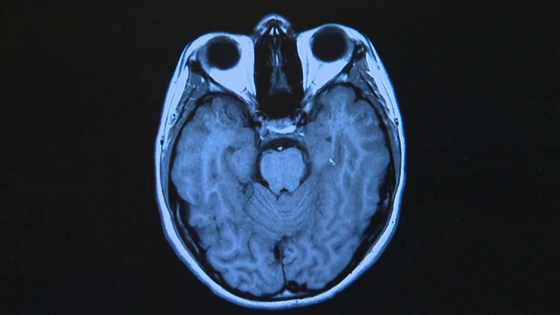 Texas A&M researcher receives a federal grant to study how brain support cells affect Alzheimer’s risk